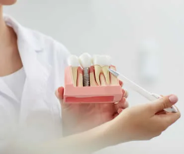 Are Dental Implants Safe?