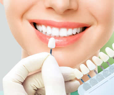 Teeth Whitening 101