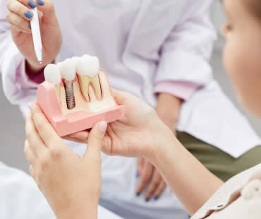 Introducing Dental Implants